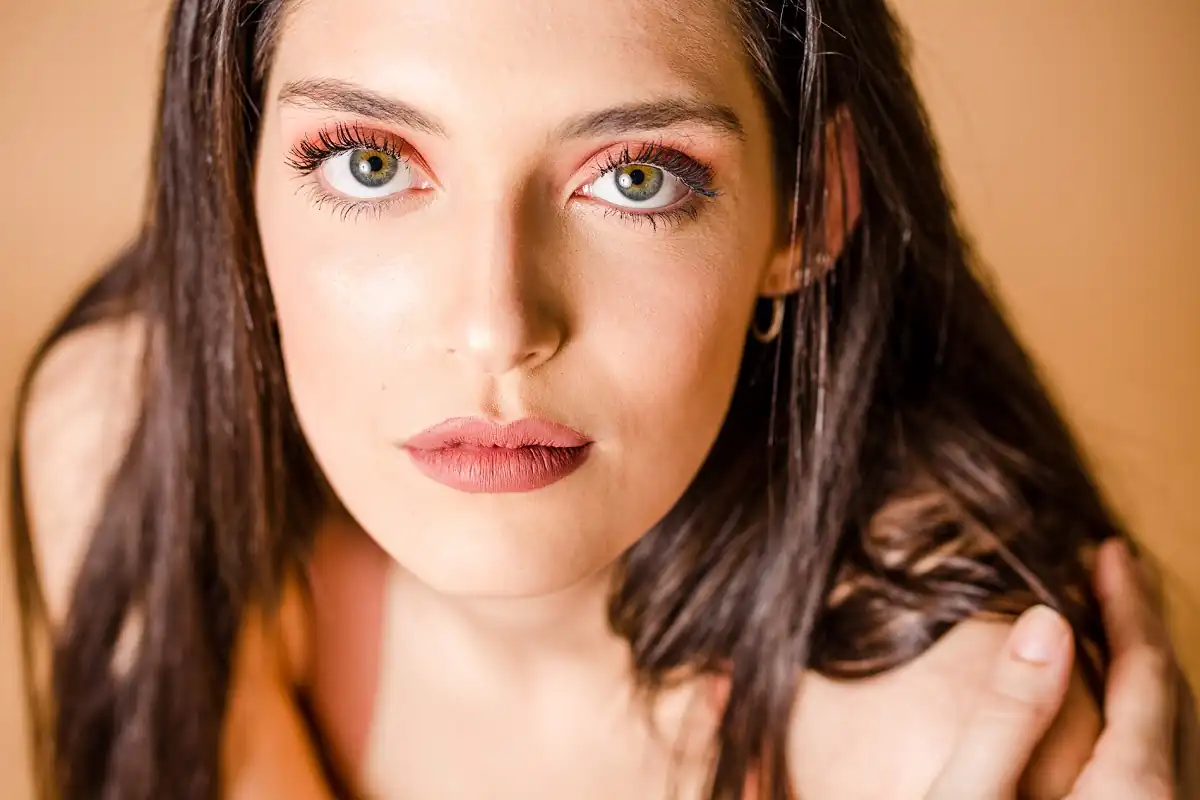 eliminar ojeras con acido hialuronico Málaga clínica Aesophy